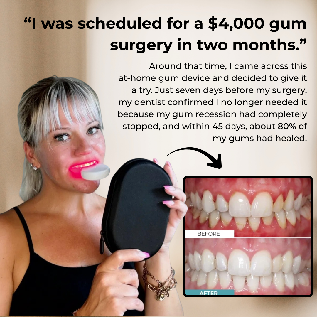 Gum Rejuvenation Device