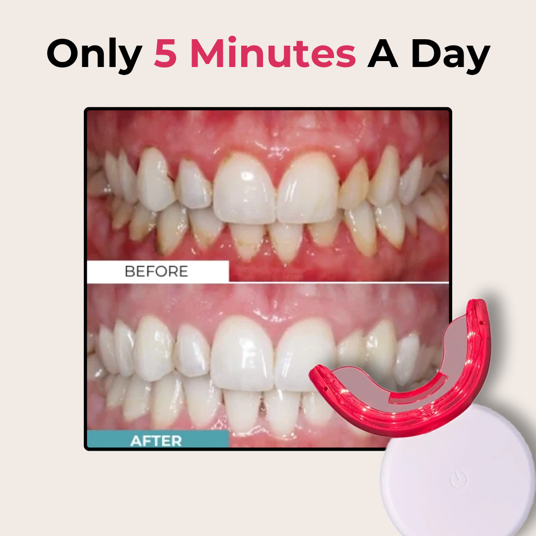 Gum Rejuvenation Device
