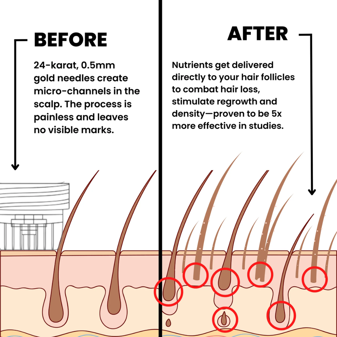 HairRegrow Kit