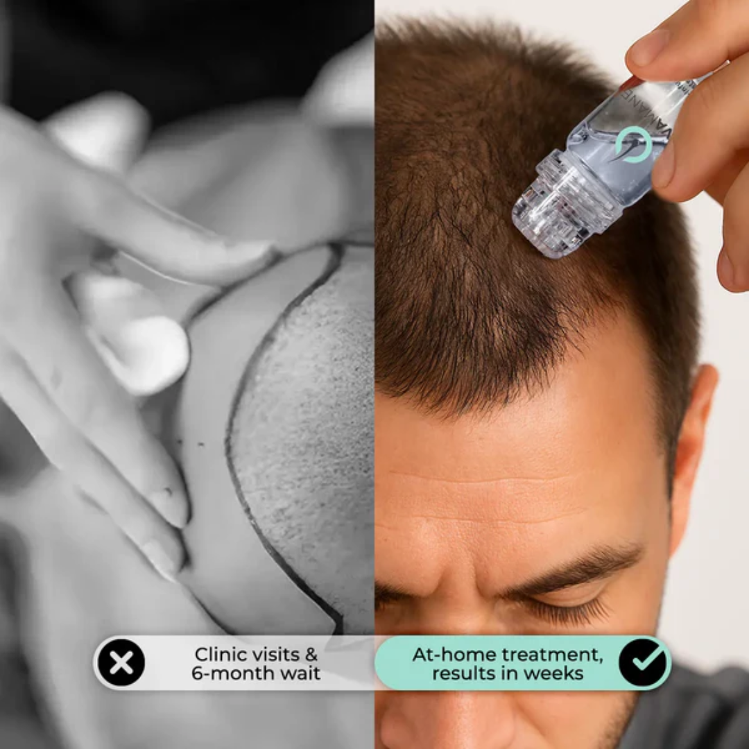 HairRegrow Kit