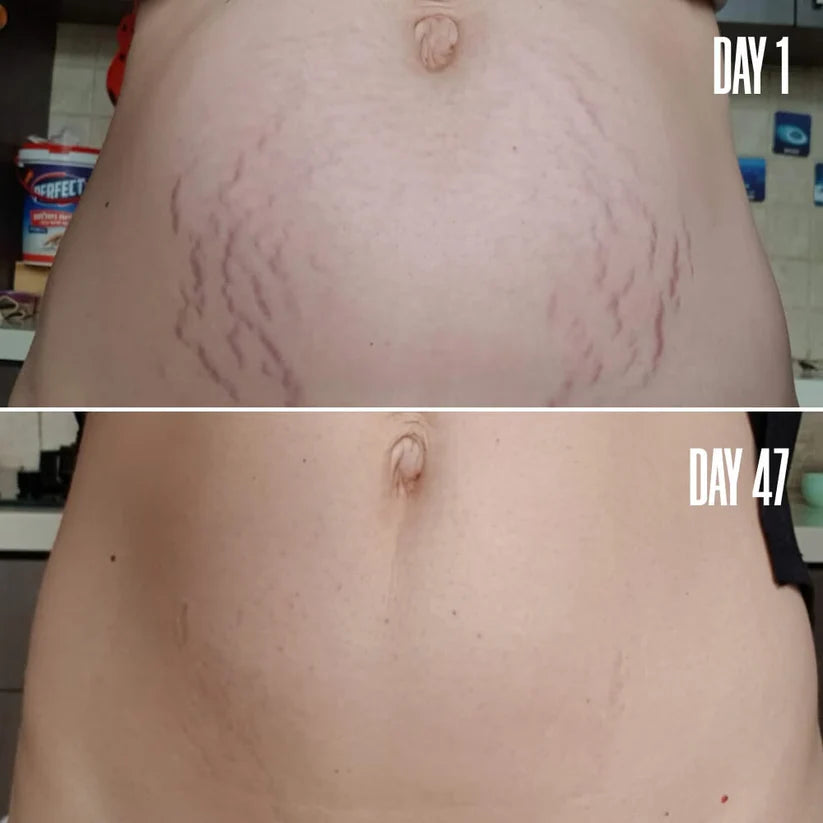 Velena™ Belly Firming Cream